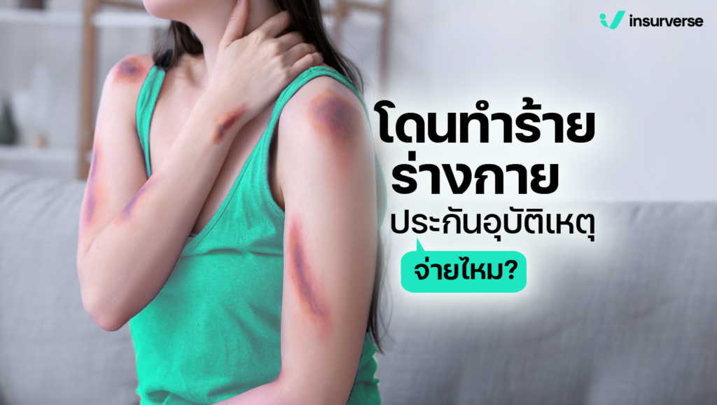 โดนทำร้ายร่างกาย ประกันอุบัติเหตุจ่ายไหม?