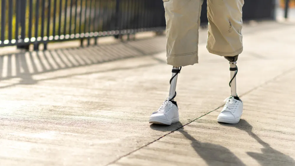view-walking-man-with-prosthetic-legs-white-sneakers