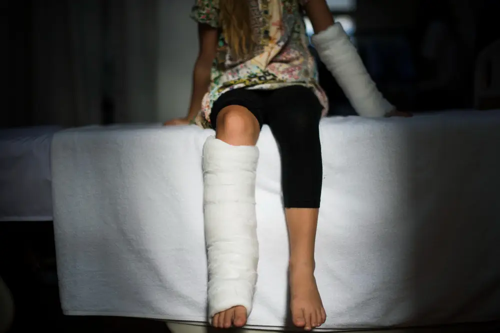 Young-girl-with-broken-leg