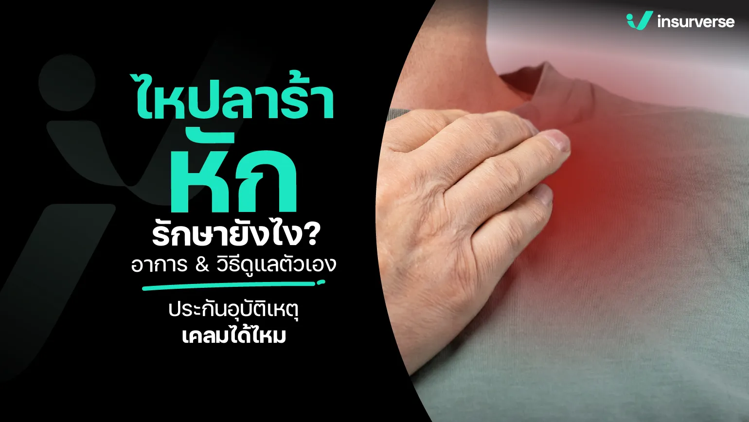 ไหปลาร้าหัก รักษายังไง? อาการ & วิธีดูแลตัวเอง ประกันอุบัติเหตุเคลมได้ไหม